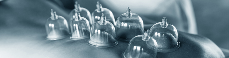 cupping reflexology